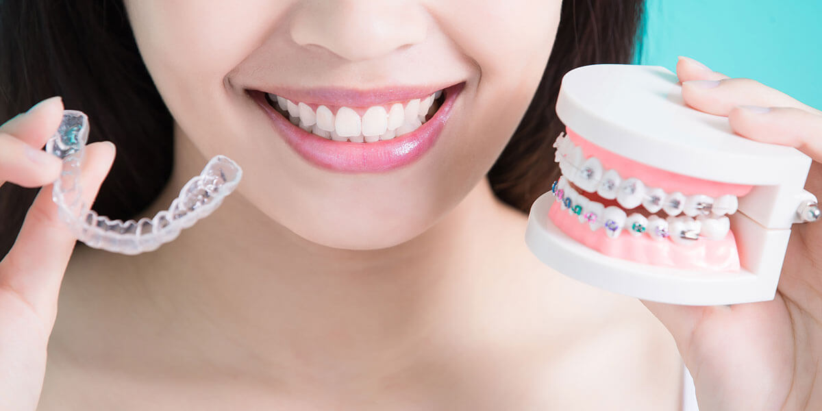Dental Braces
