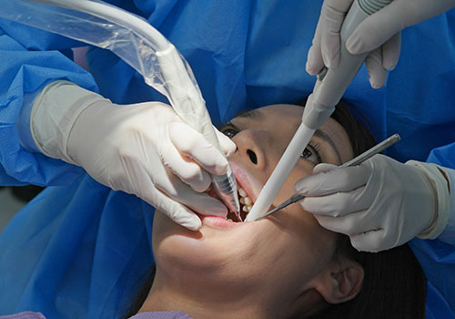 Root Canal Treatment clinic in kolkata